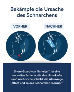 Snore Guard Schnarchschiene